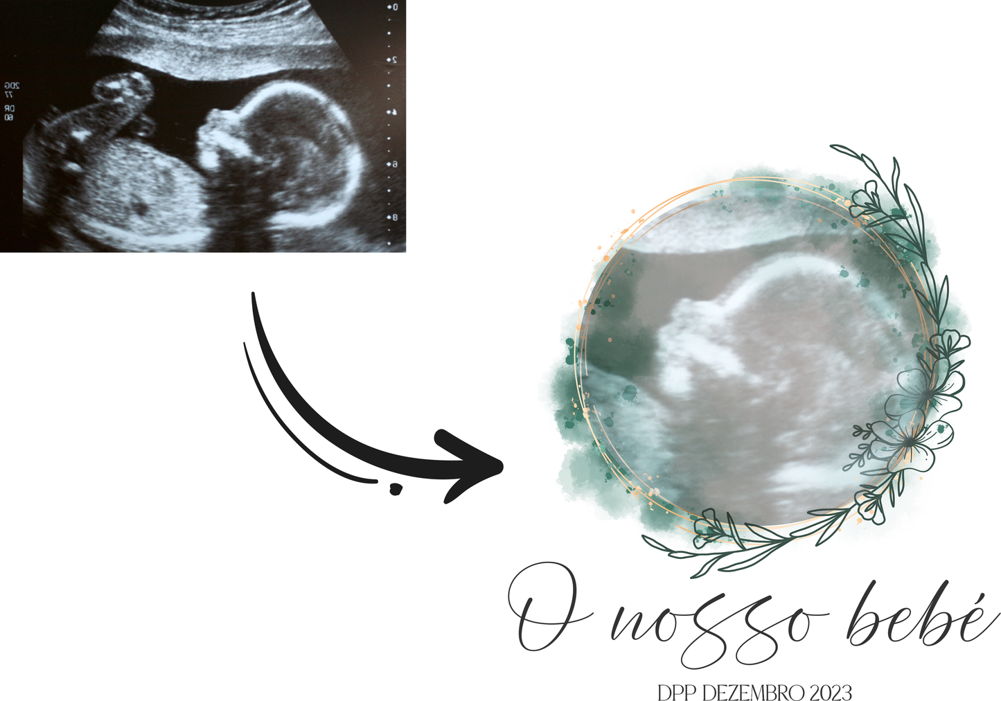 Ecografia Personalizada "O Nosso Bebé" com Data Prevista Para Parto - Revelação Gravidez, Quadro Digital- FICHEIRO DIGITAL